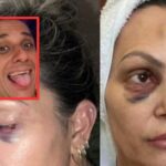 Personal espancada em Cuiabá faz live e expõe desejos sexuais de ex-namorado policial: “Eu era obrigada”