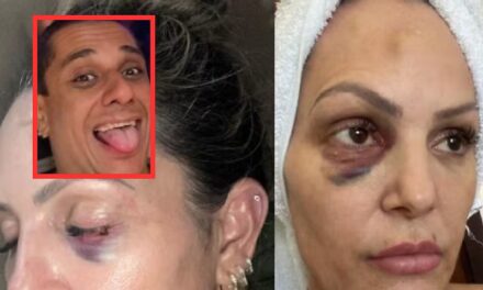 Personal espancada em Cuiabá faz live e expõe desejos sexuais de ex-namorado policial: “Eu era obrigada”