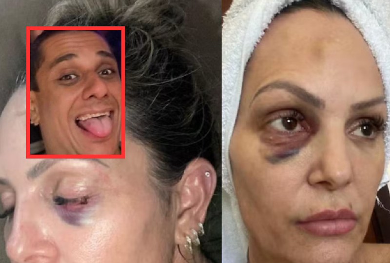 Personal espancada em Cuiabá faz live e expõe desejos sexuais de ex-namorado policial: “Eu era obrigada”