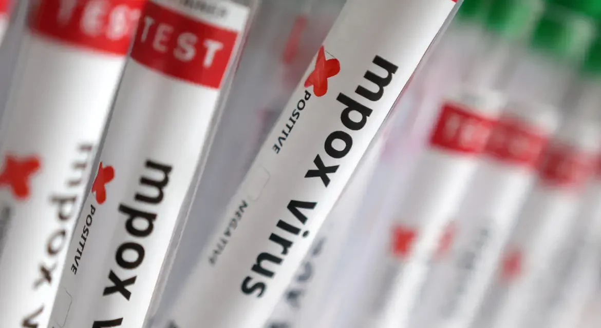 Sobe para 140 número de casos confirmados de Mpox no país, em 2026