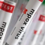 Sobe para 140 número de casos confirmados de Mpox no país, em 2026