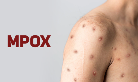 Cuiabá emite alerta epidemiológico para mpox e reforça vigilância