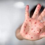 Mato Grosso registra 53 casos de meningite; 51% são crianças e adolescentes