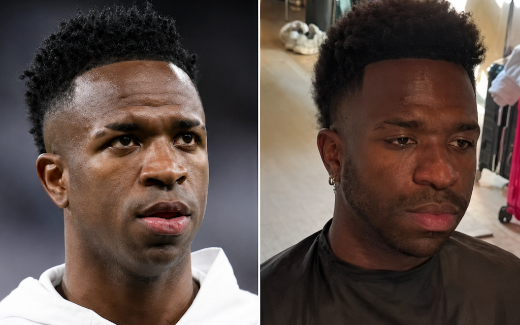 Vinicius Junior realizou um procedimento estético facial.