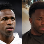 Vinicius Junior realizou um procedimento estético facial.