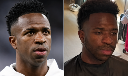 Vinicius Junior realizou um procedimento estético facial.